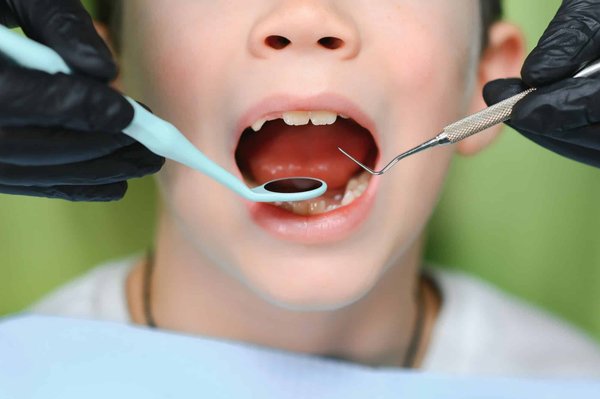 Quels sont les traitements pour les dents de sagesse en clinique ?